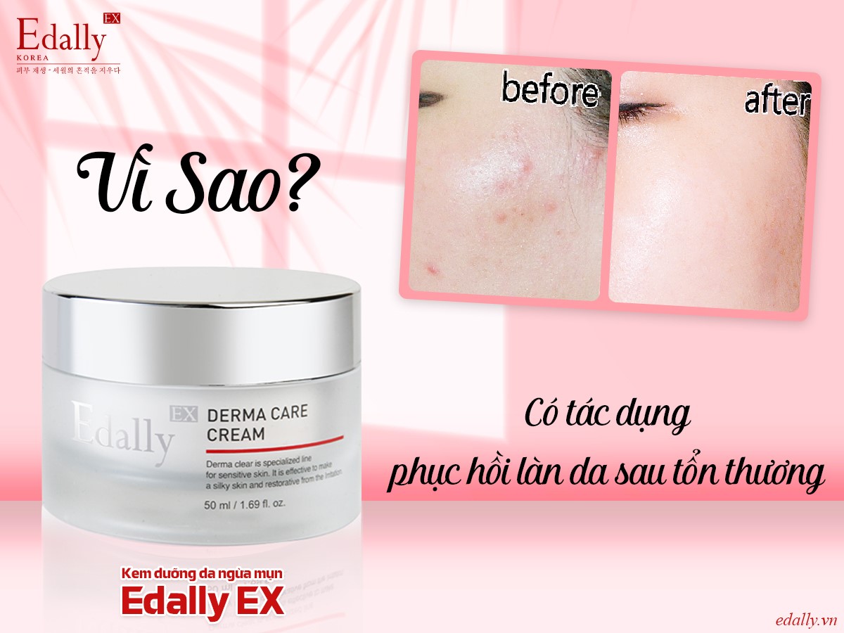 VÌ SAO KEM DƯỠNG DA NGỪA MỤN EDALLY EX CÓ TÁC DỤNG PHỤC HỒI LÀN DA SAU TỔN THƯƠNG?